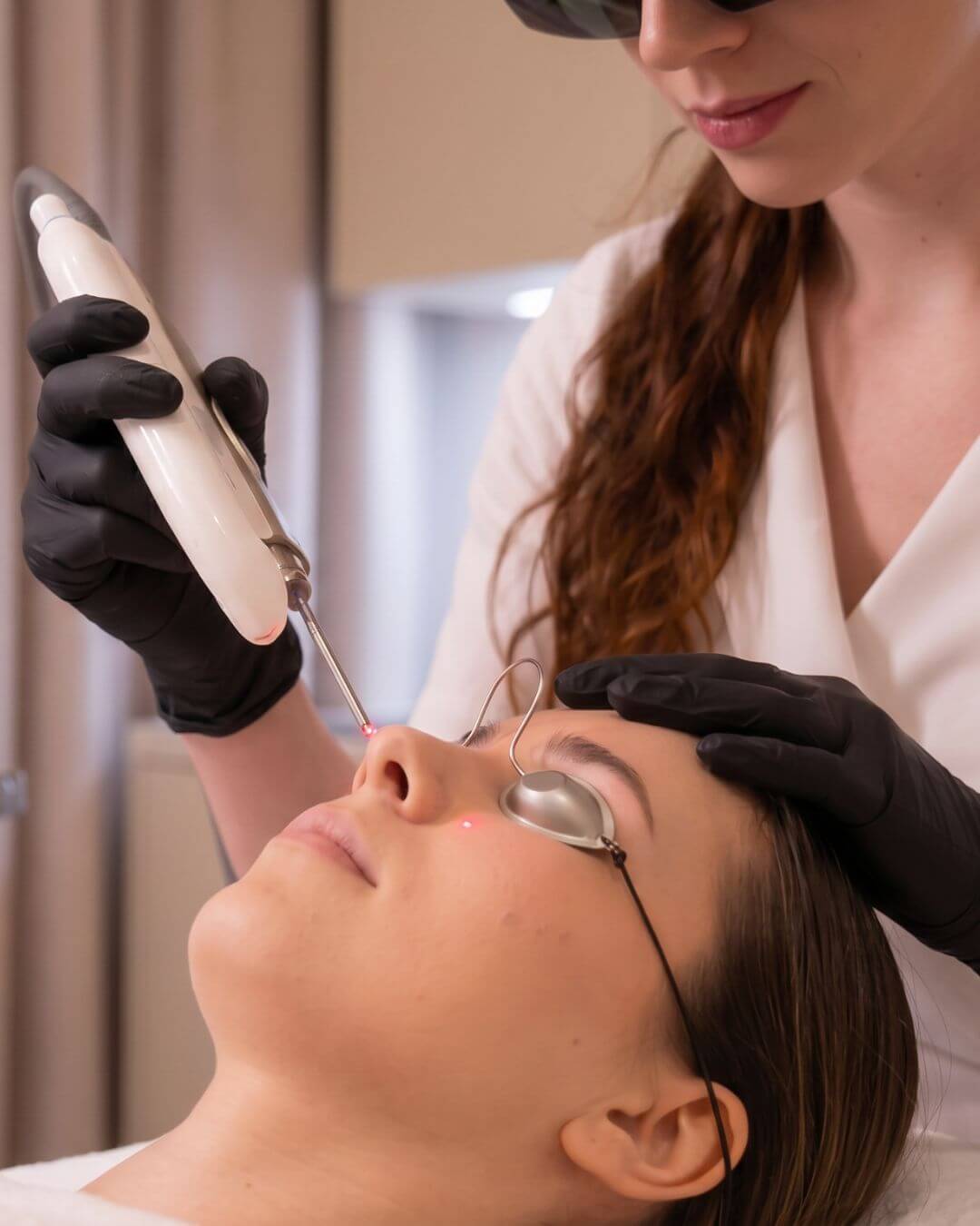 Laserové ošetrenie očného okolia Bratislava - beautylab