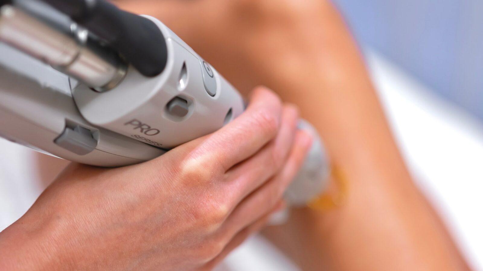 PCOS ochlpenie a laser Bratislava BeautyLab