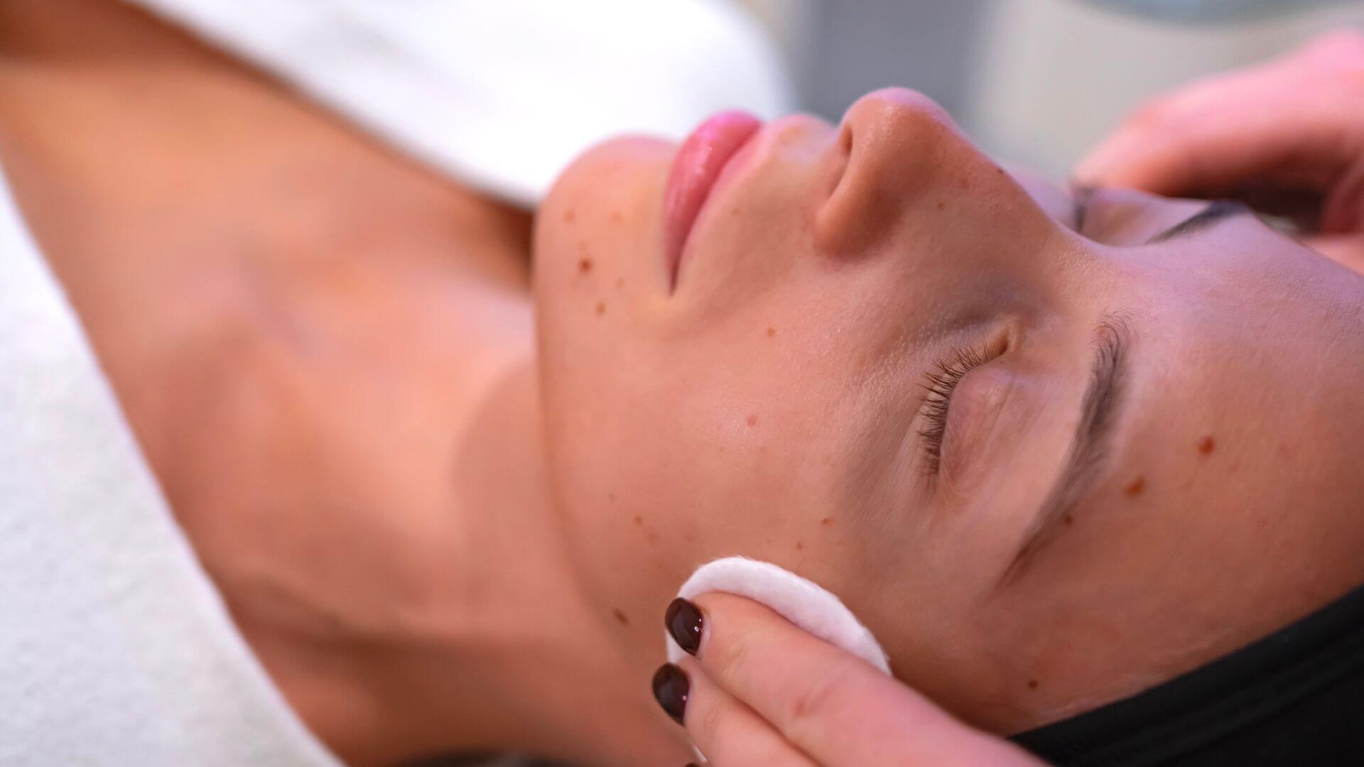 Prečo sa laser a peeling robia až na jeseň a čo s pleťou dovtedy