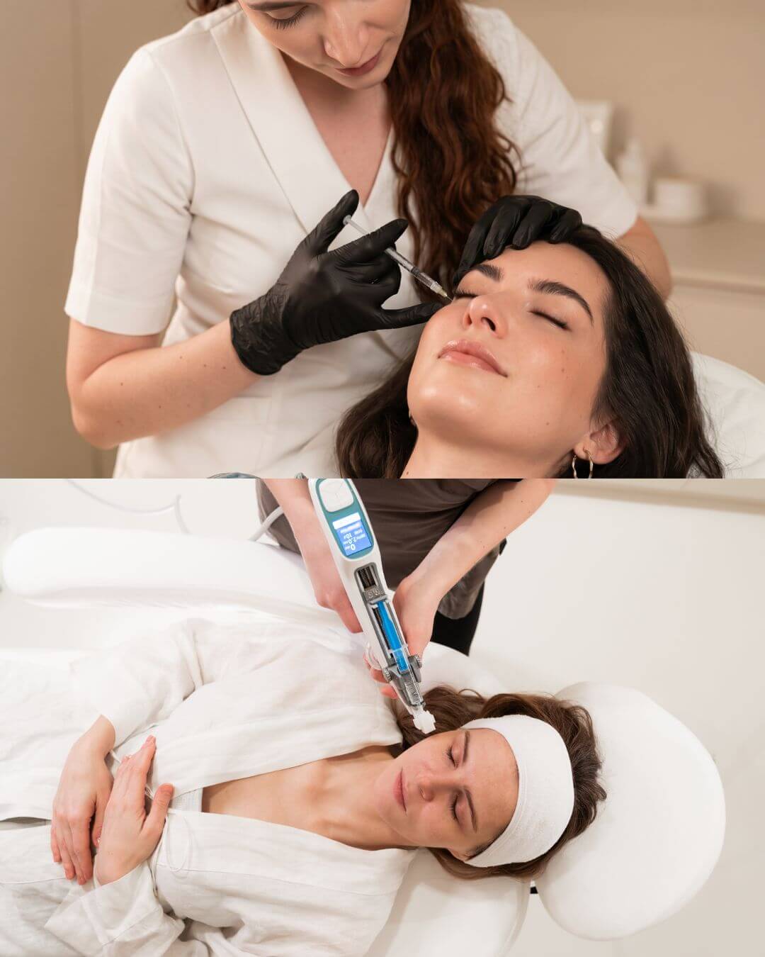 aplikacia polynukleotidy-beautylab-bratislava