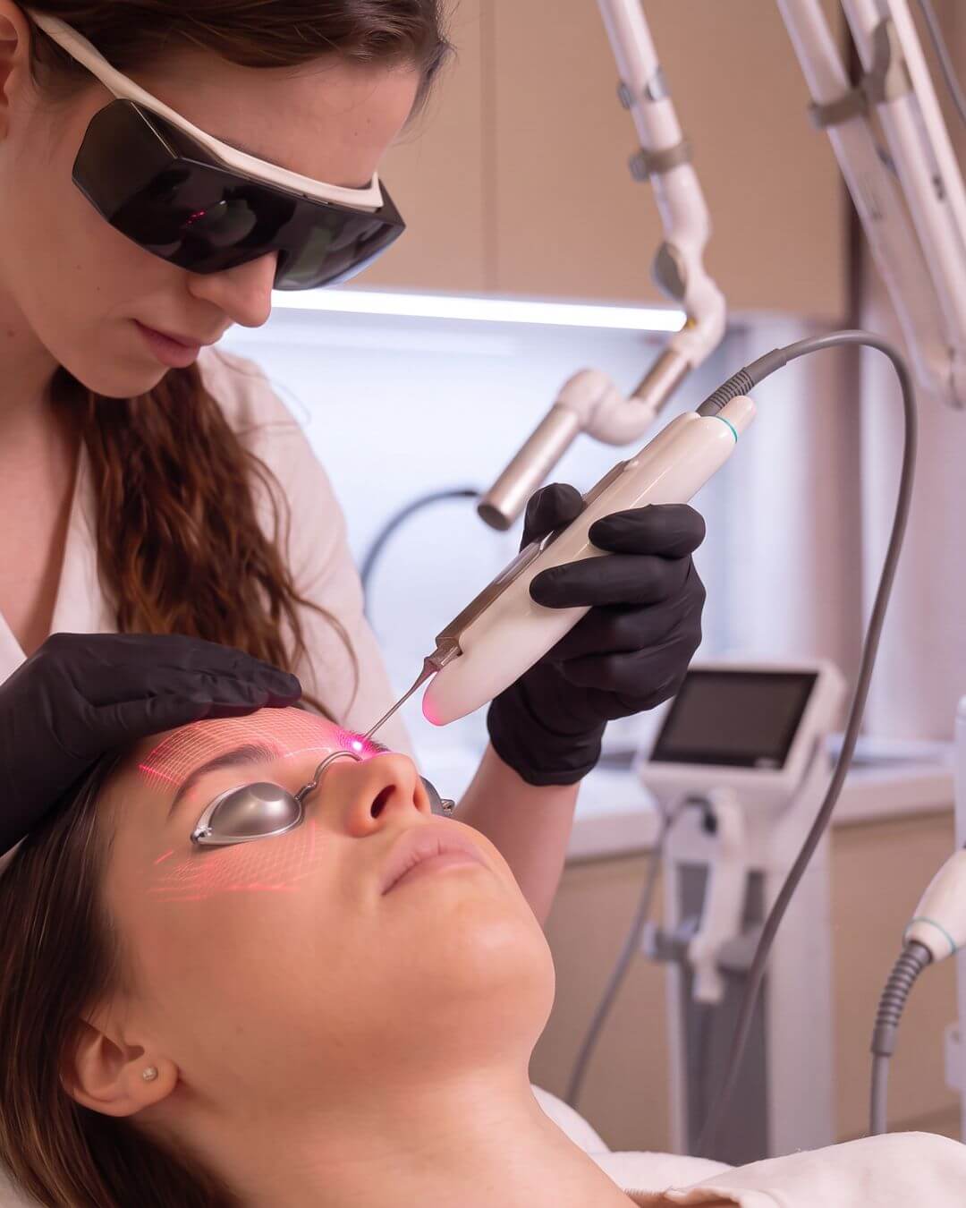 lifting obočia laserom-beautylab bratislava (1)