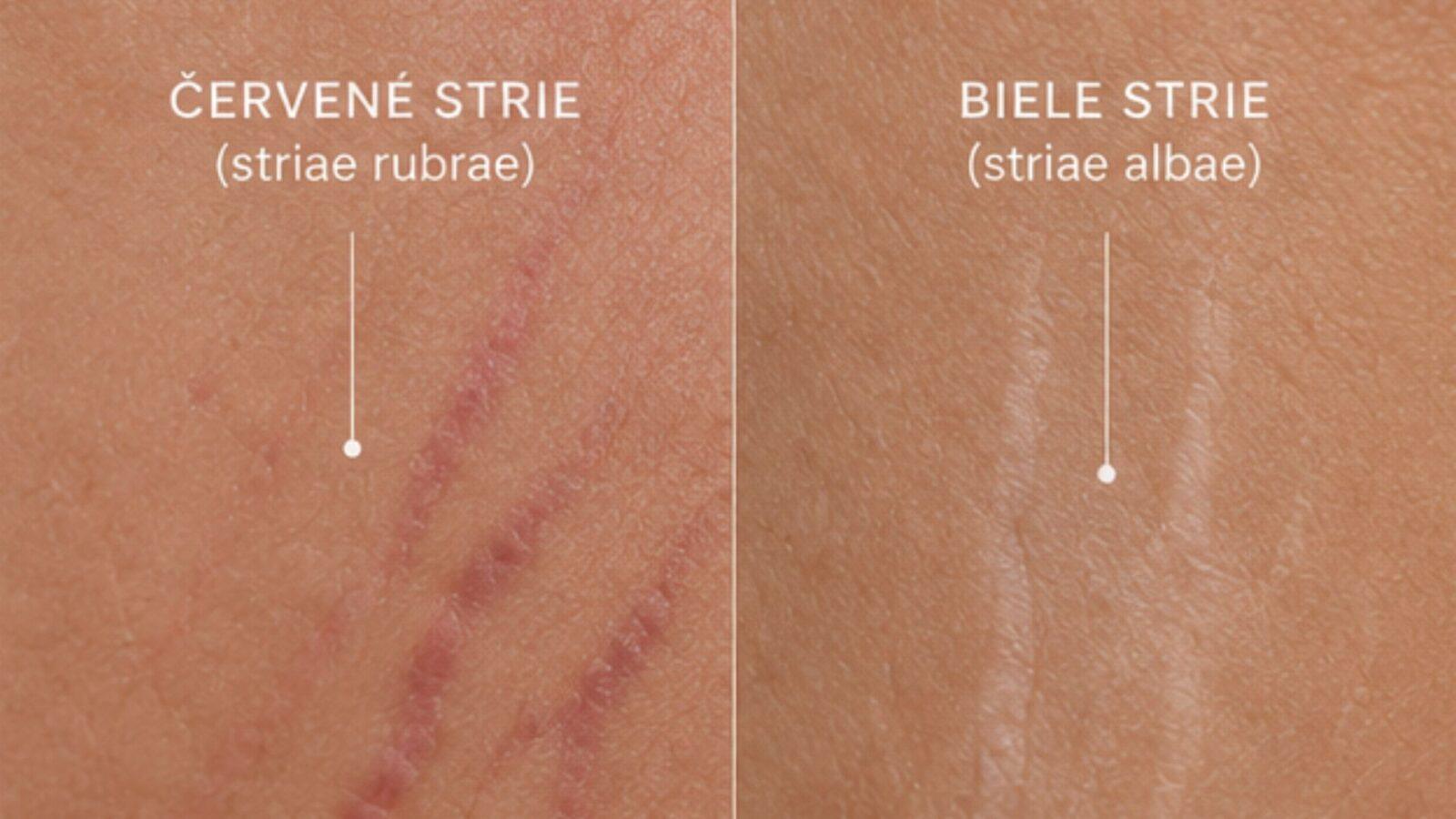 strie červené a biele bratislava beautylab